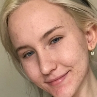 Trippi Miki Naken