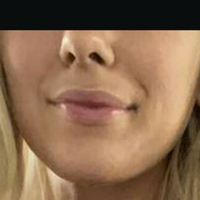 Wettmelons Naken