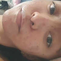 xsugarvulpesx Naken